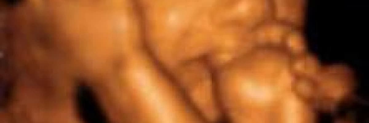 Yeni teknoloji 4 Boyutlu Ultrasonun Diğerlerine Göre Üstünlükleri