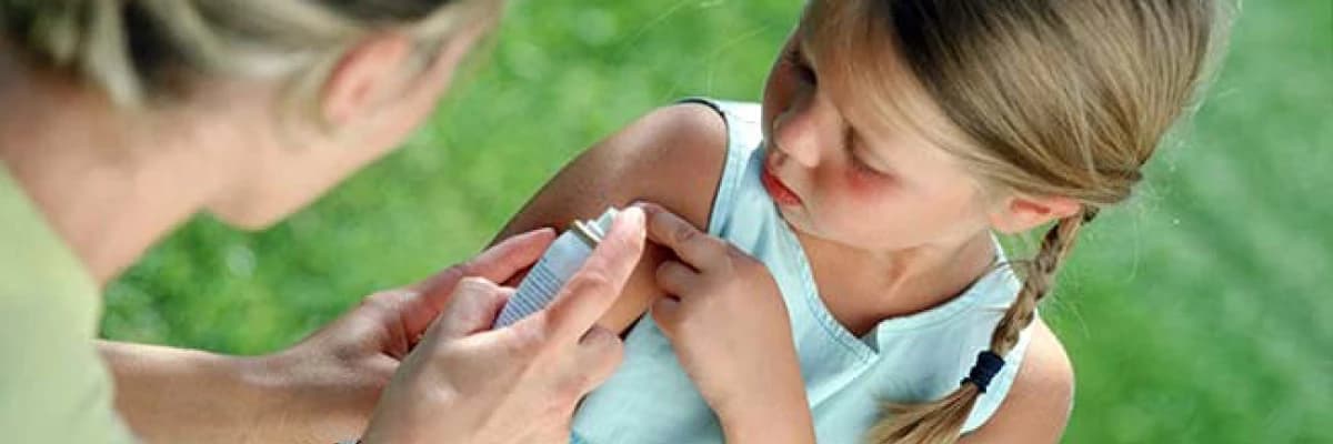 Böcek Isırıklarında Evde Hemen Yapılacaklar