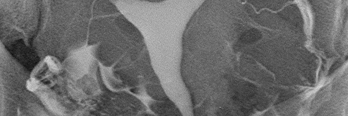 Rahim filmi [HSG] çekiminde teknik ve teknolojik yenilikler