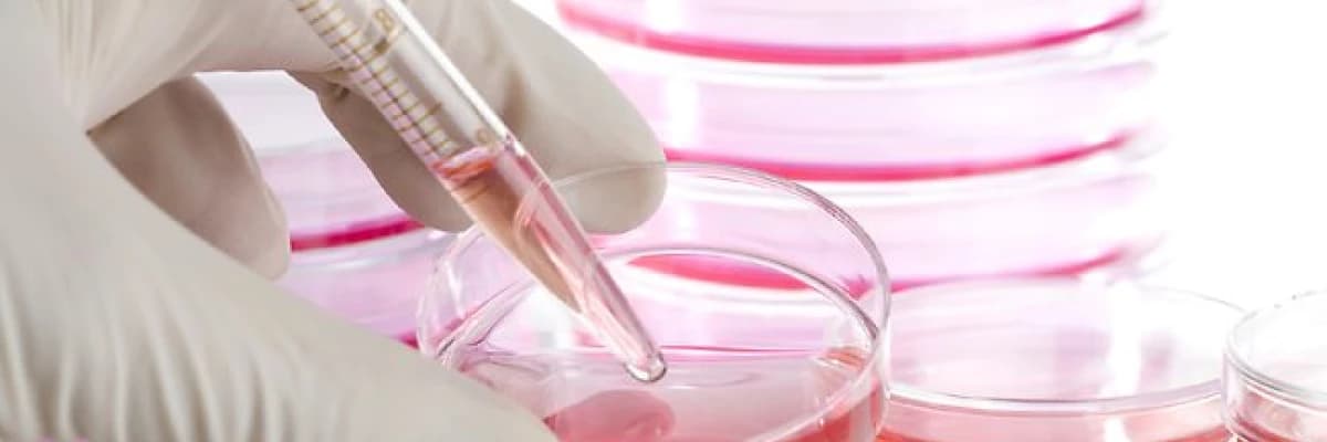 Kök hücre tedavileri