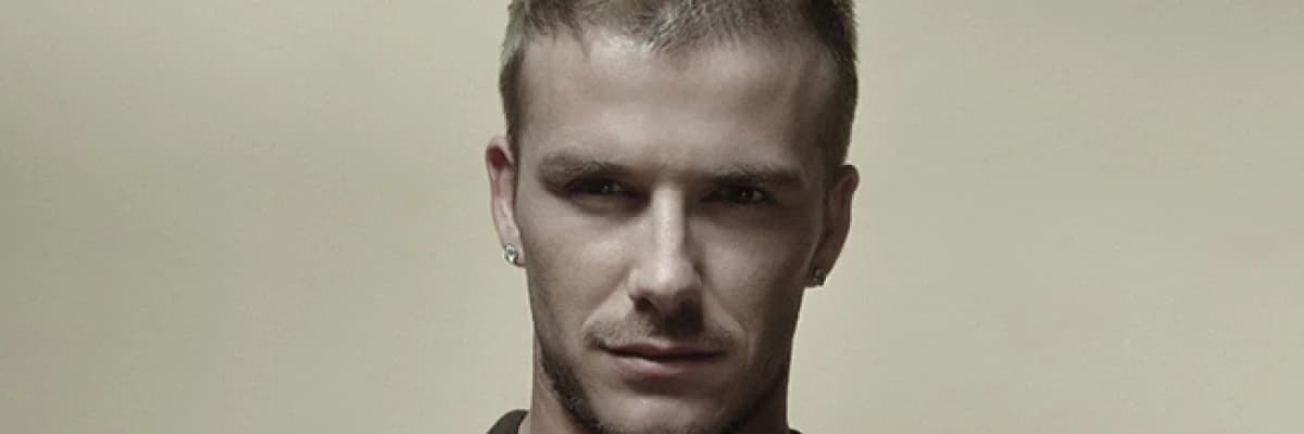 Saç ekiminde “10 e kuralı”