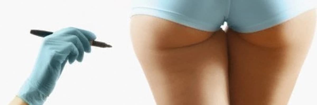 Protezle popo büyütme, akla gelen ilk “10 soru”