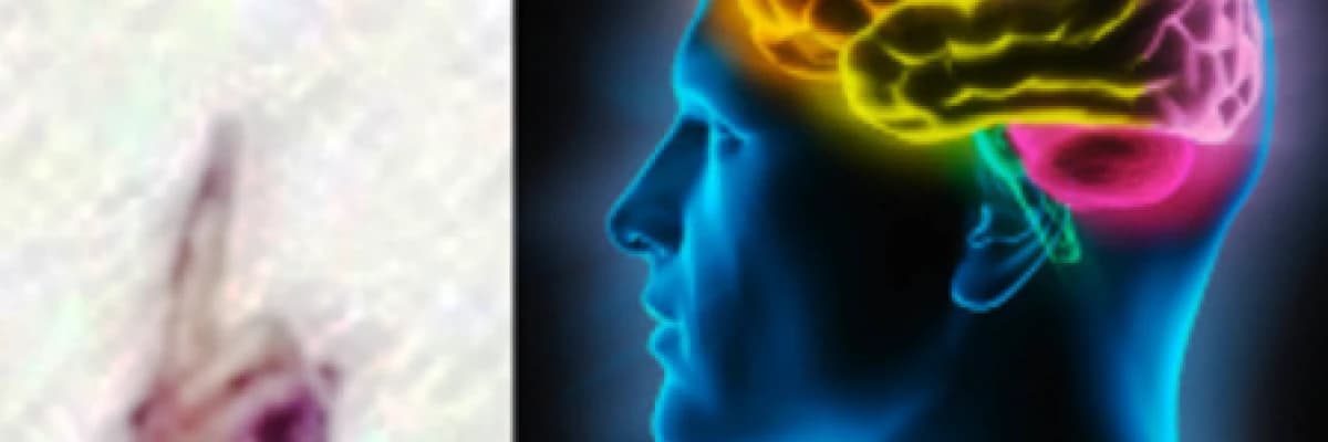 Emdr terapisi ve vaka örneği