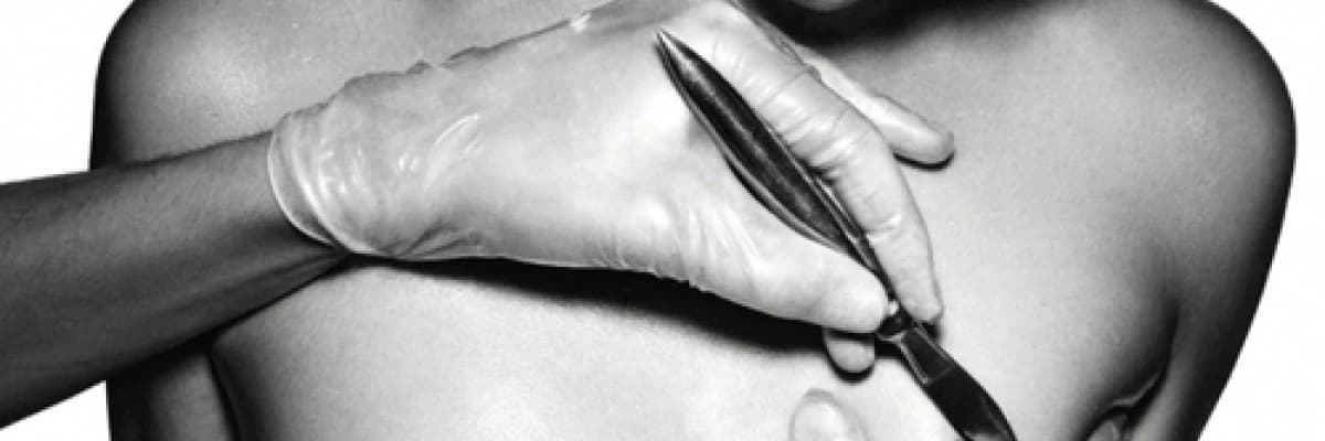 Silikonla meme büyütme: en çok merak edilen ve sorulan 22 soruya cevap