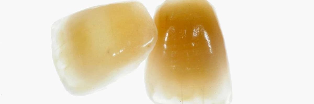 Zirkonyum diş kaplama