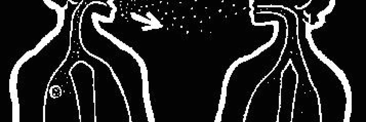 Verem nasıl bir hastalıktır?