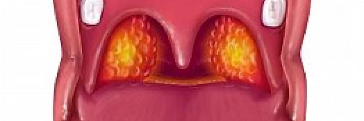 Reflü ile farenjiti karıştırmayın