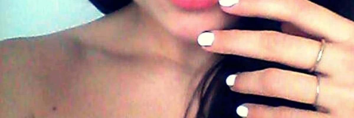 Alan etkisi: estetik amaçlı girişimler hangi koşullarda yapılmamalı !