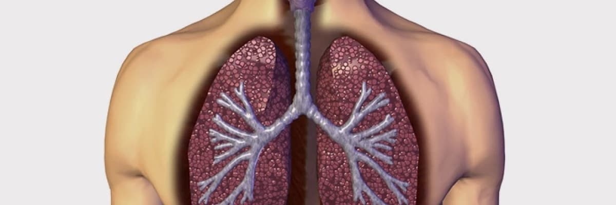 Pnömotoraks ve uçuş