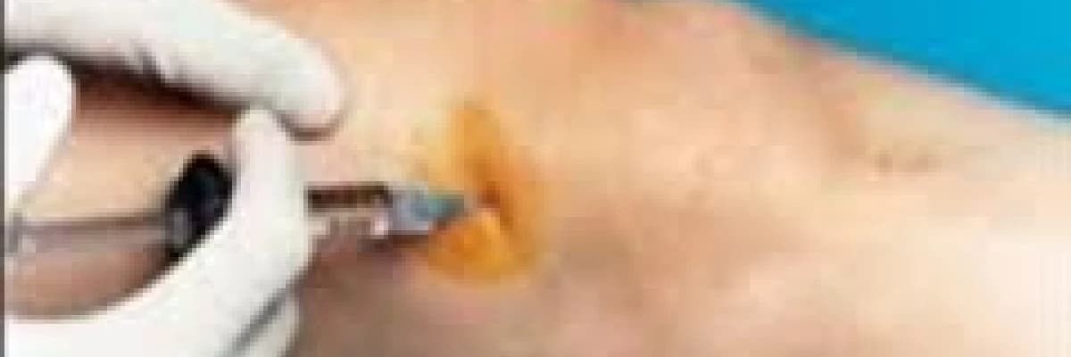 Diz kireçlenmelerinde prp tedavisinin etkinliği: