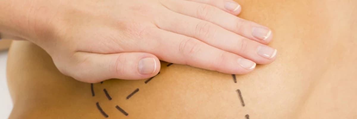 Meme dikleştirme nedir?