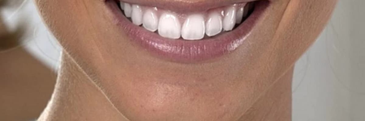 Dişleri beyazlatmadan daha beyaz göstermenin yöntemler