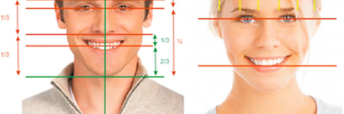 Ön dişlerde estetik