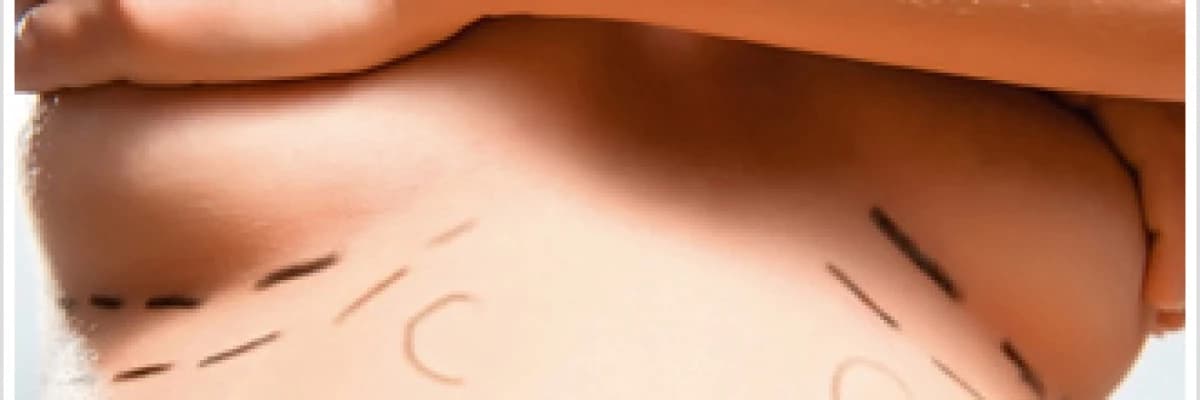 Meme dikleştirme nasıl yapılır?