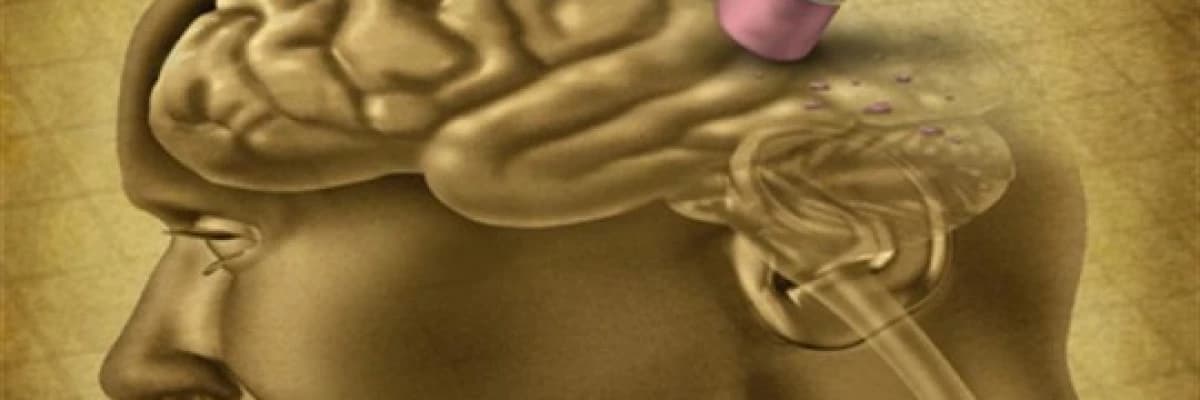 Her unutkanlık alzheimer mı?