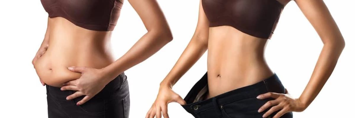 Yağ aldırma (liposuction)