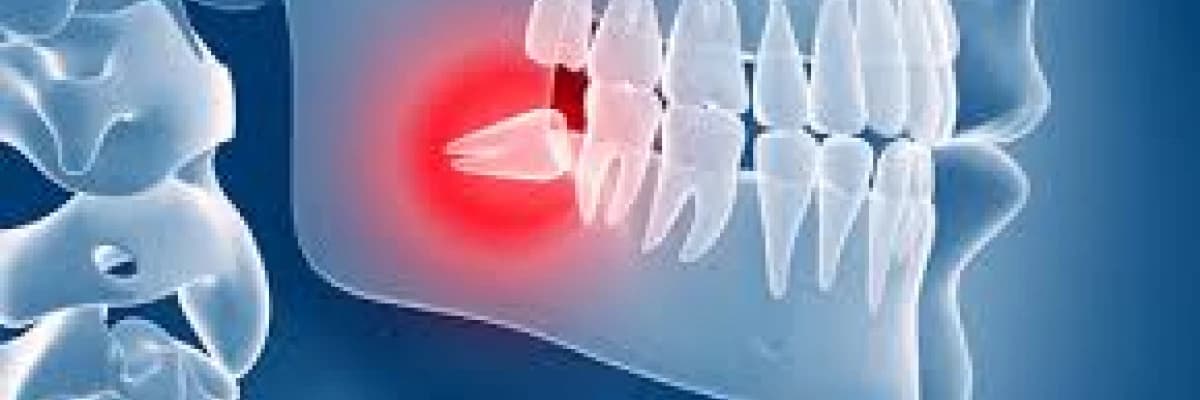 Gömülü 20 yaş dişi cerrahisi