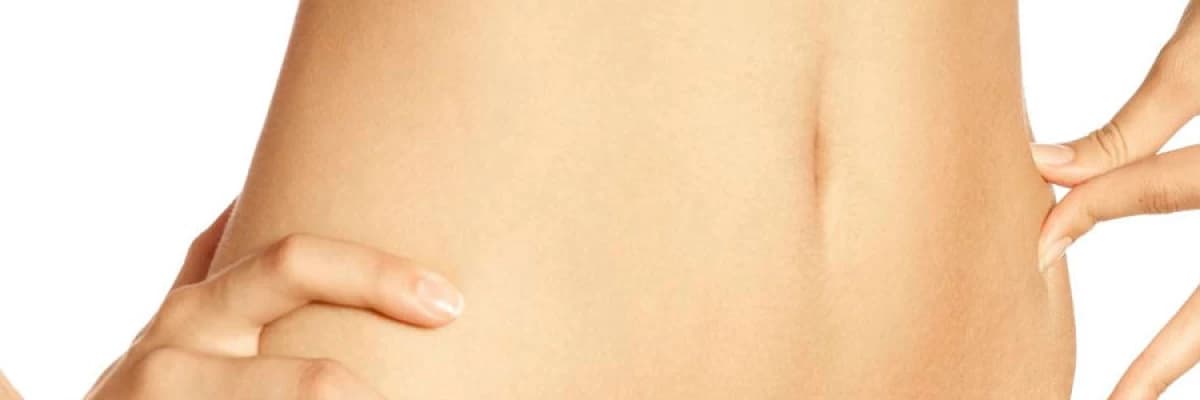 Karın germe ameliyatı (tummy-tuck)
