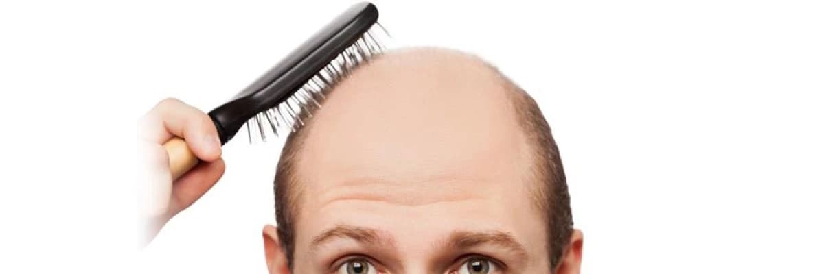 Fut (foliküler unite transplantasyonu) saç ekim yöntemi