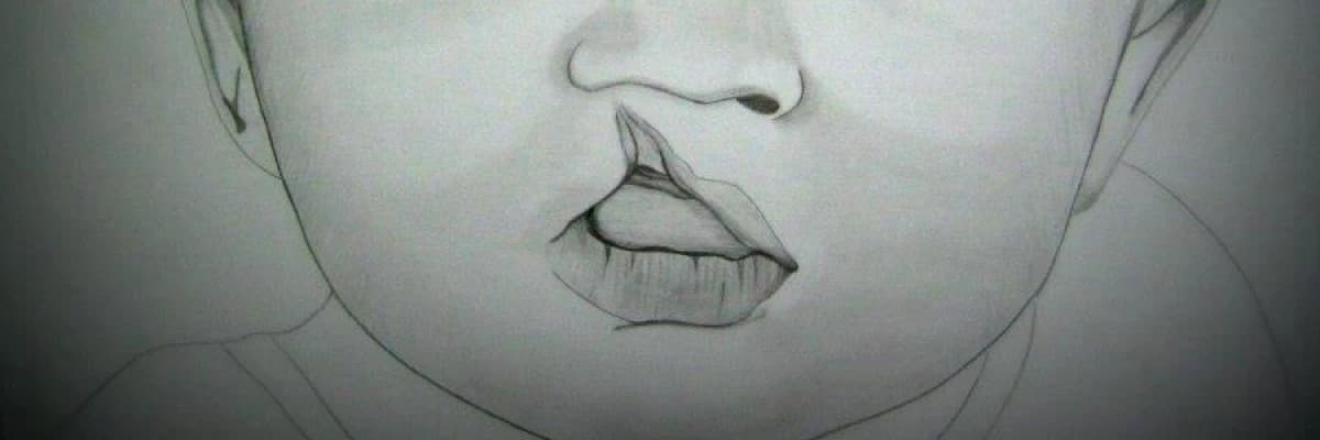 Dudak  ve  damak  yarıkları