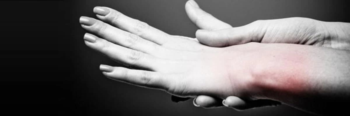 Yanık nasıl oluşur ?