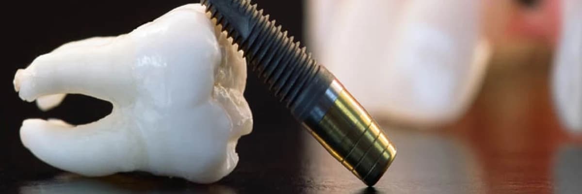 Diş çekimi ve cerrahi işlemler sonrası tavsiyeler