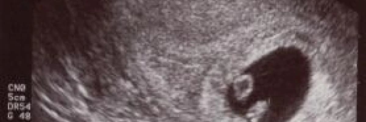 Ultrasonografi nedir,ne değildir?