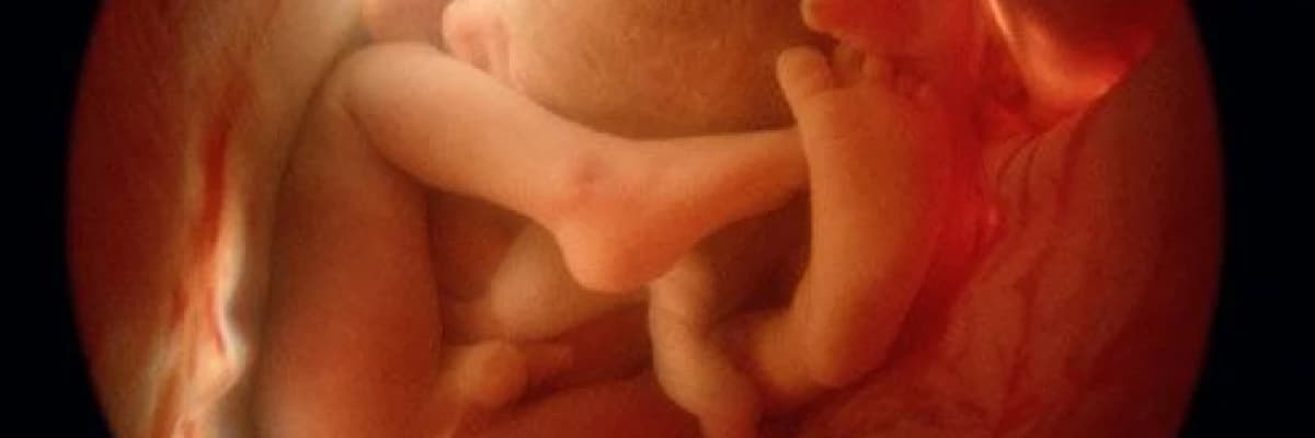 Fetal anomaliler hakkında genel bilgiler