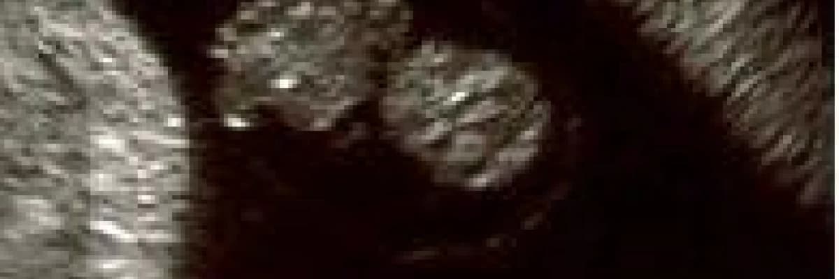 Hafta hafta gebelik: 6-10. Haftalar