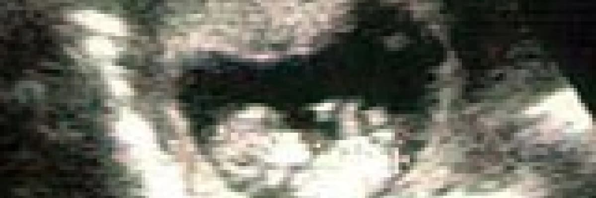 Hafta hafta gebelik: 11-15. Haftalar