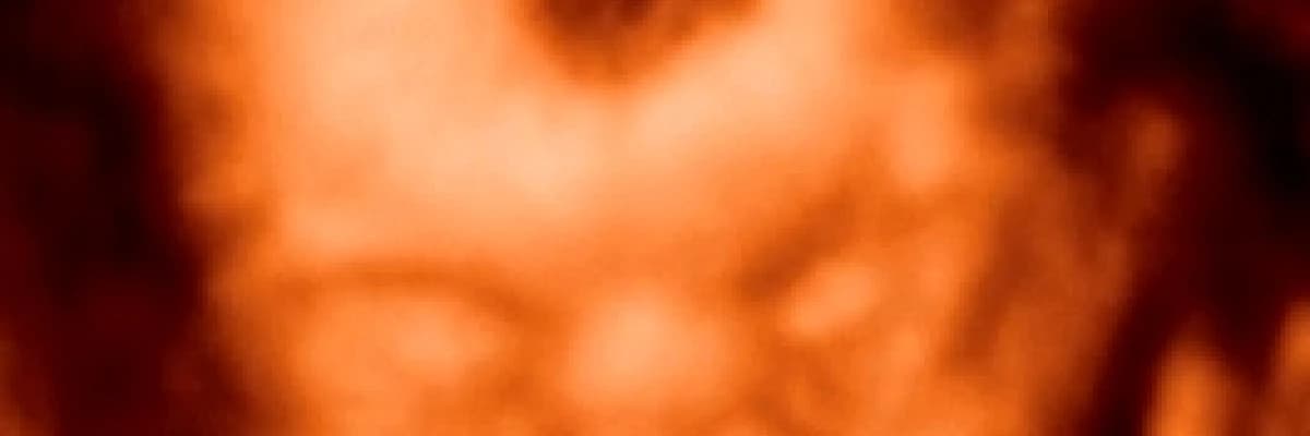 Hafta hafta gebelik: 26-30. Haftalar