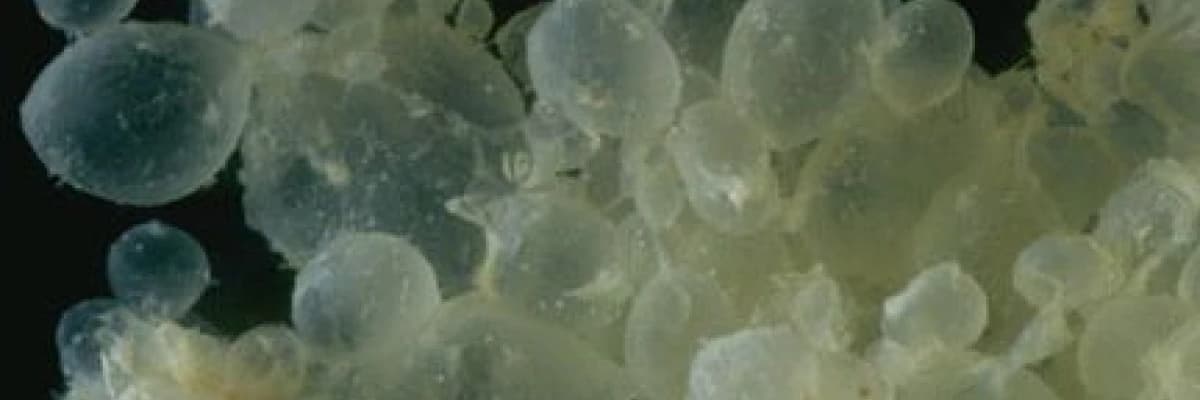 Mol  gebeliği (üzüm gebeliği)