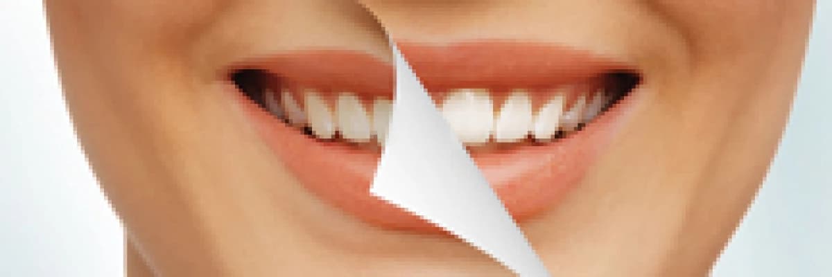 Estetik diş hakkında