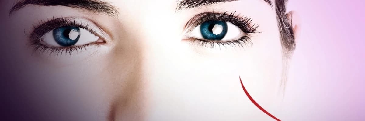 Kaş ekimi kimlere yapılır?