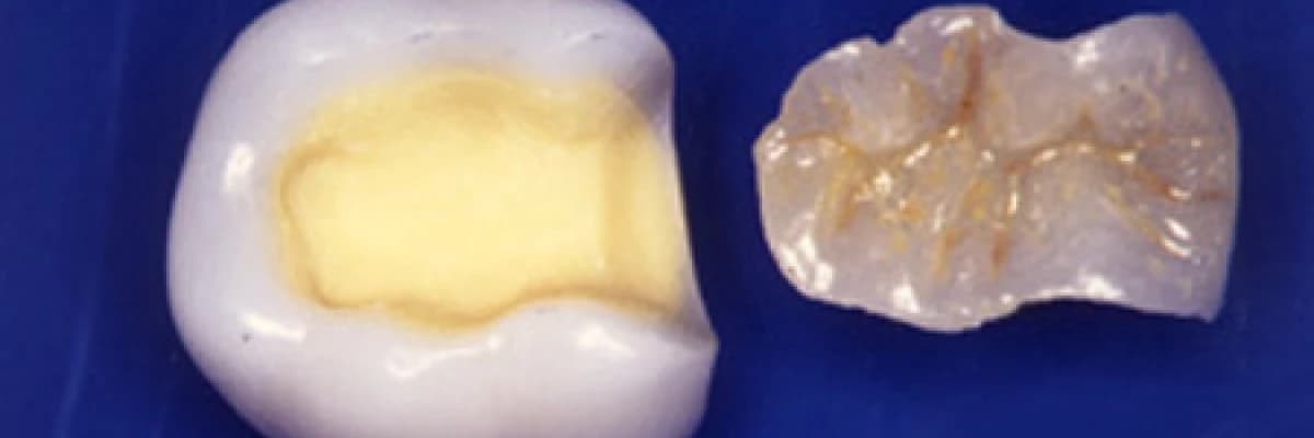 İnley-onley seramik dolgular