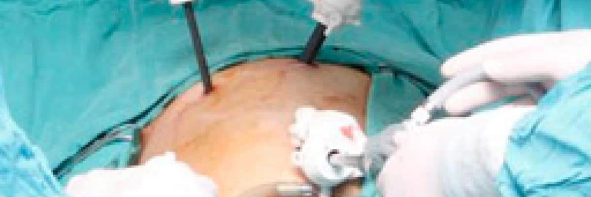 Laporoskopik cerrahi