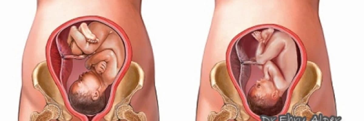 Gebelikte kızamıkçık enfeksiyonu - rubella