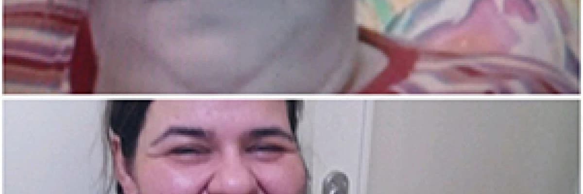 Tüp mide ameliyatında olabilen ama diğer obezite ameliyatlarındada görülebilecek riskler nelerdir?