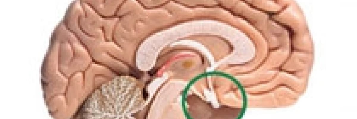 Hipofiz bezi tümörü