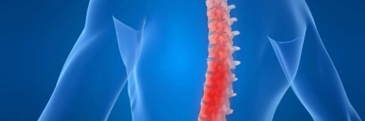 Skolyoz ve nedenleri