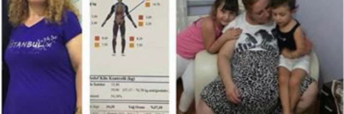 Tüp mide ameliyatı sonrası beslenme