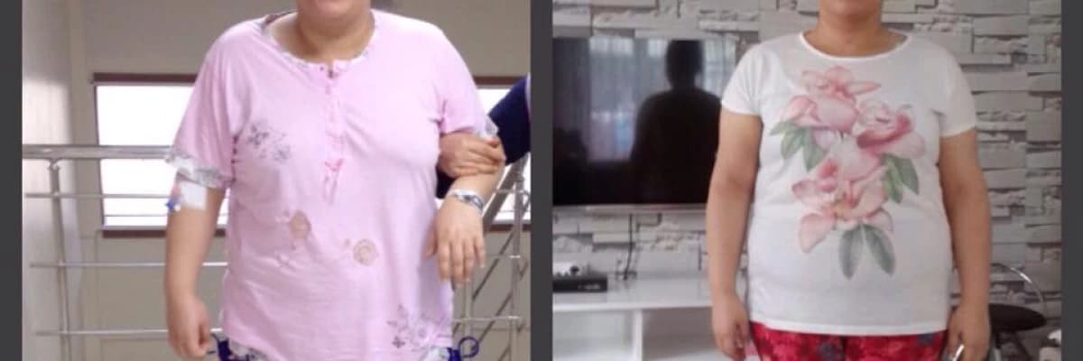 Obezite ameliyatı sonrası yaşam