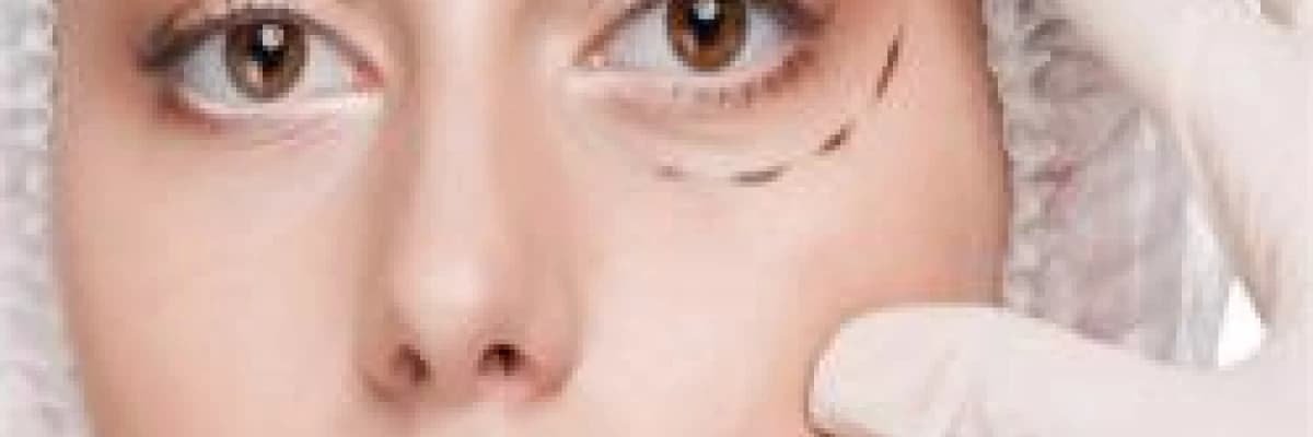 Oküloplastik cerrahi