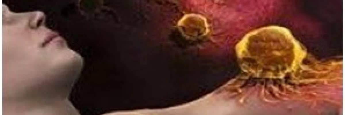 Meme kanseri risk faktörleri