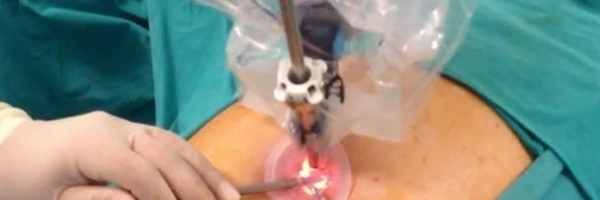 Robotik ve laparoskopik cerrahi (minimal invaziv cerrahi)