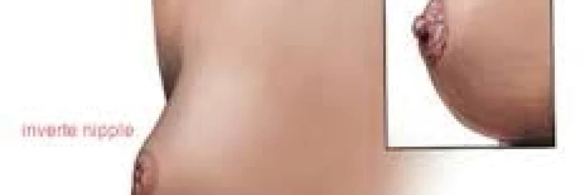 Meme  dikleştirme!!