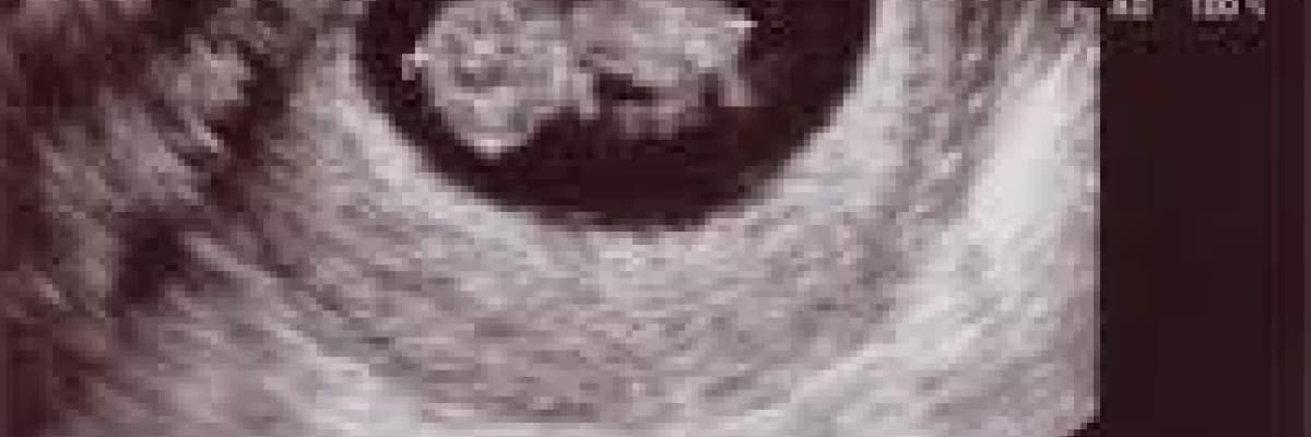 Bebeğin gelişimi ve  ilk 10 hafta