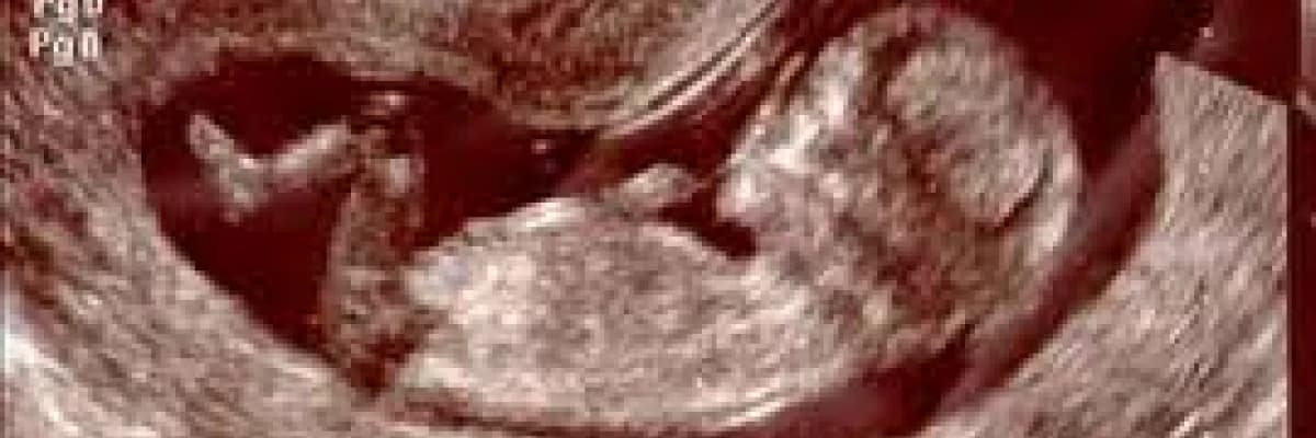 Gebeliğinizin  11. İle 20.hafta arasındaki değişimleri