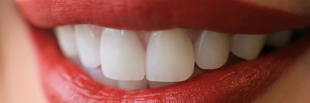 Kron (kaplama) veya köprü yapım aşamaları nelerdir?