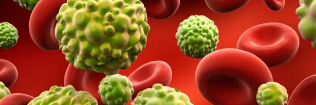 Obezite ve kanser ilişkisi